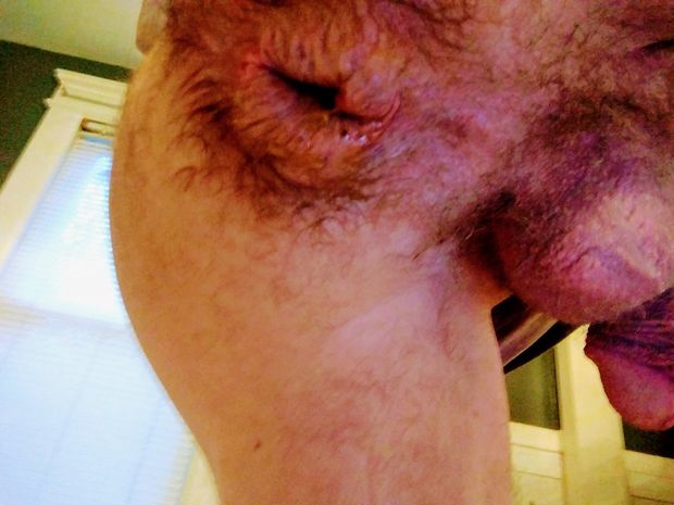 Gay butthole