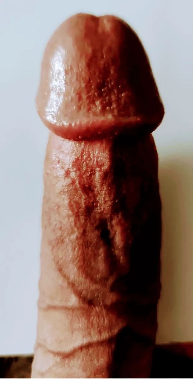 Dick