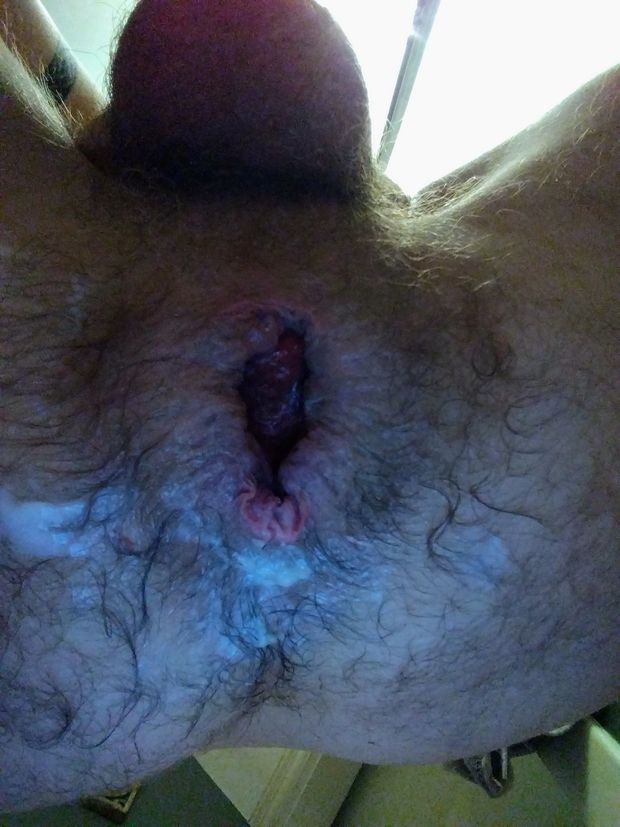 Rust ass
