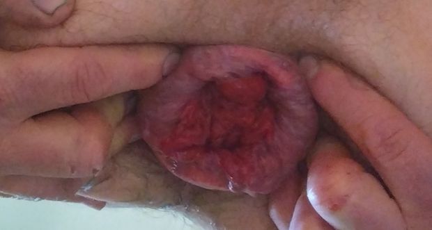 Rusti ass