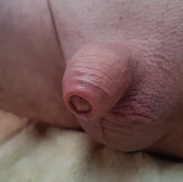 My hairless babydick