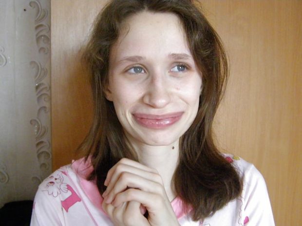 My smile