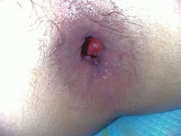 Japanese asshole