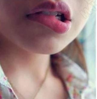 Lips