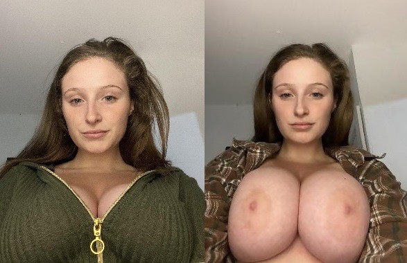 before after