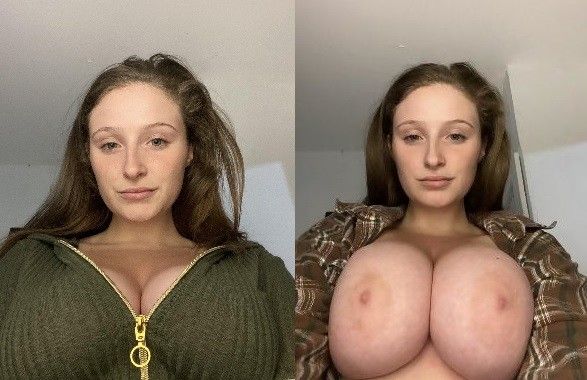 before after