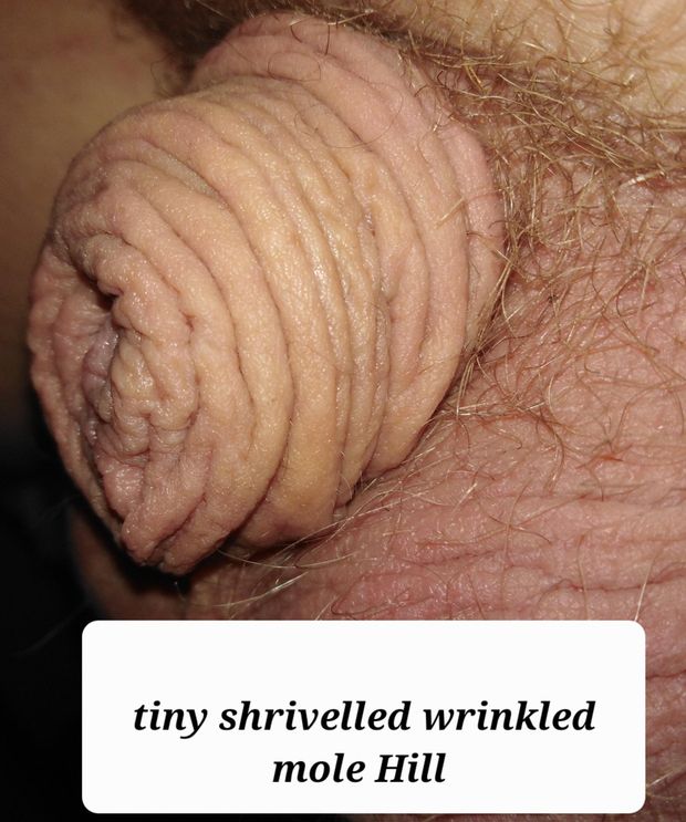 My tiny shrivelled wrinkled weiner