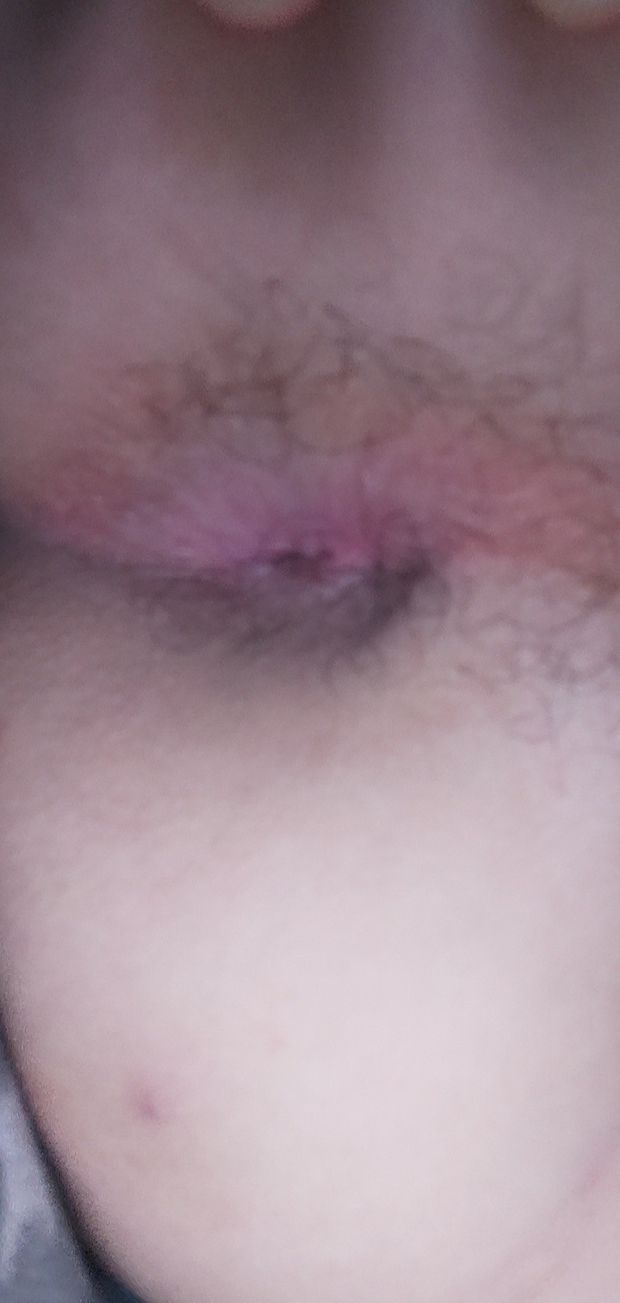 My hairy ass