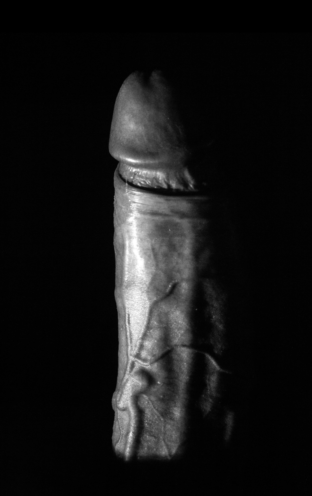 some veins