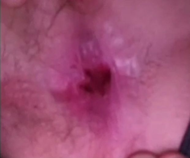 My asshole inside