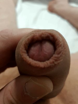 Foreskin play
