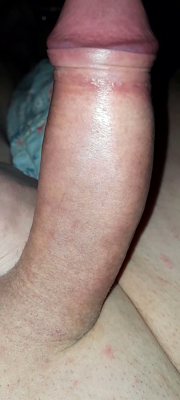 my hard shaved cock)