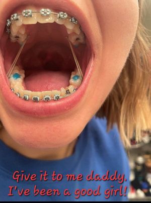 Give her that warm sticky load right on the braces!