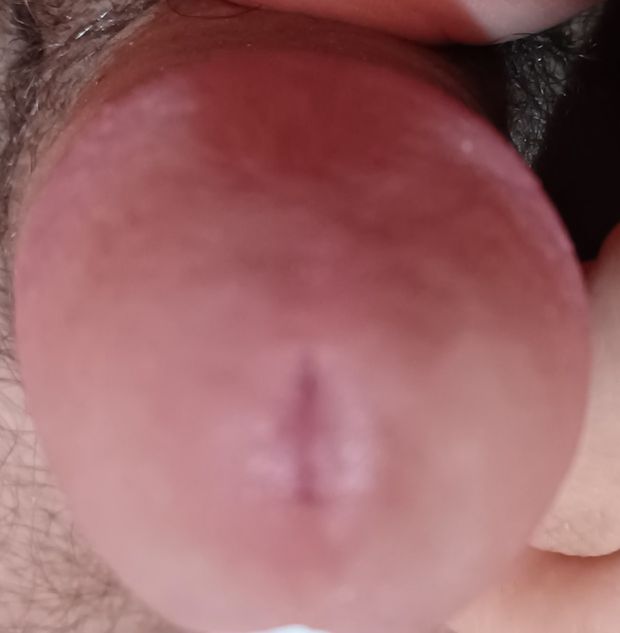 my dick