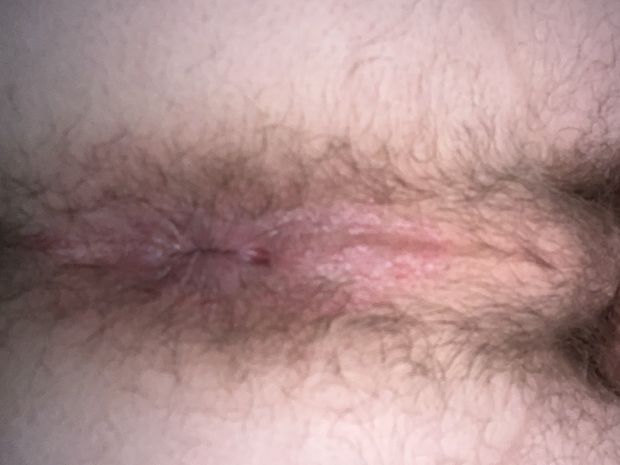 Hairy hole ready for cock