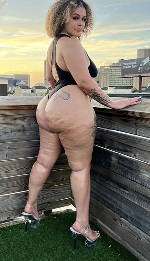 Real women have cellulite