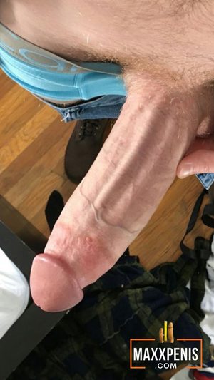 What a truly MAGNIFICENT projecting rigid erect PENIS... 10/10