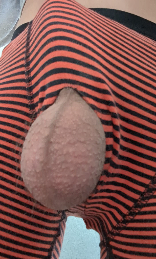 BALLS
