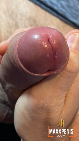 Close-up pic of uncut helmet with the foreskin just peeling back.