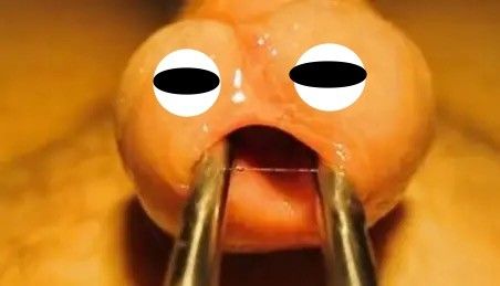 “Aaahhhhhhh”