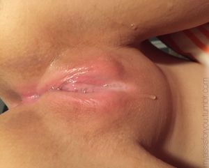 Dripping in frustration