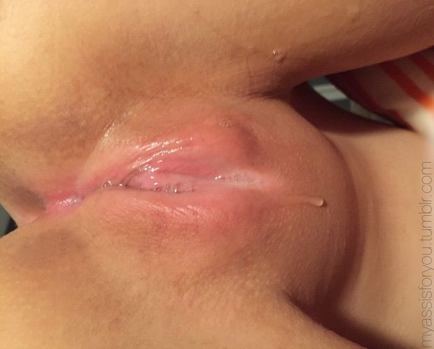 Dripping in frustration