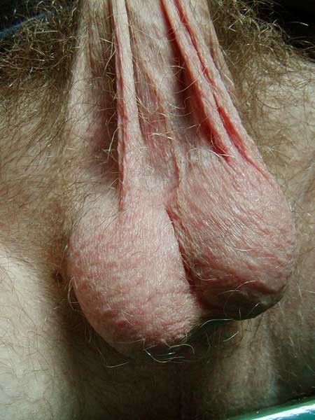 hanging balls