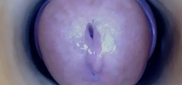 close up