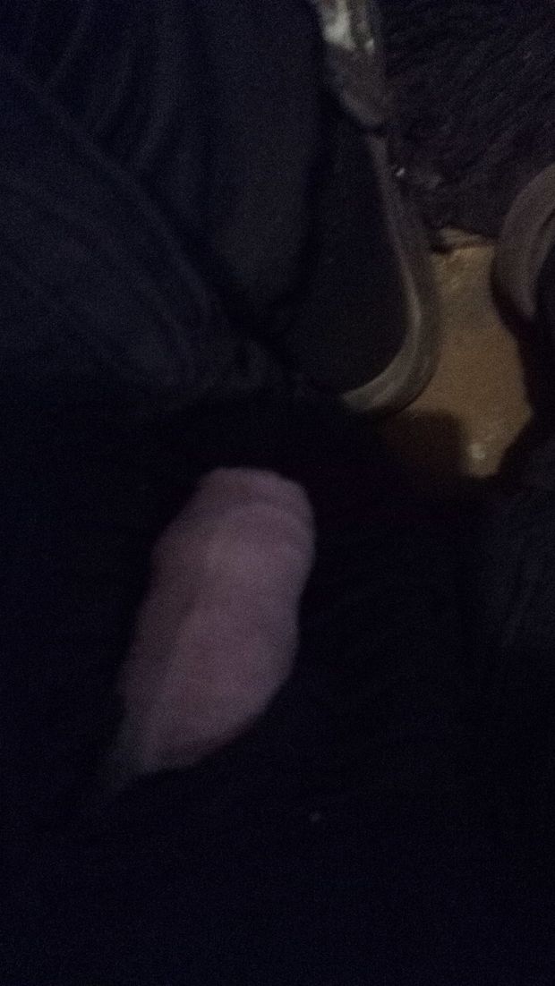 It fell out