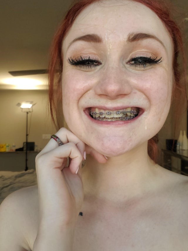 Redhead
