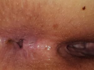 My wife's beautiful butthole