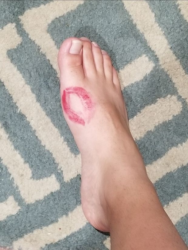 Kiss Them