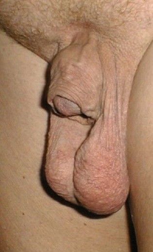 big ball retrackted cock
