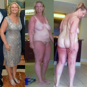 Dressed-Undressed One Piece Tanline