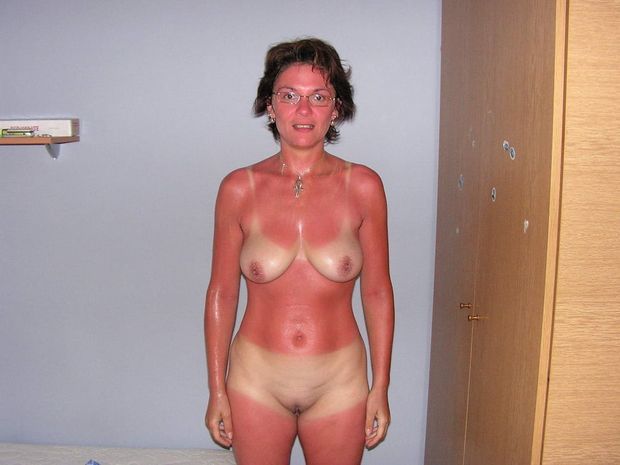 MEGA Sunburn