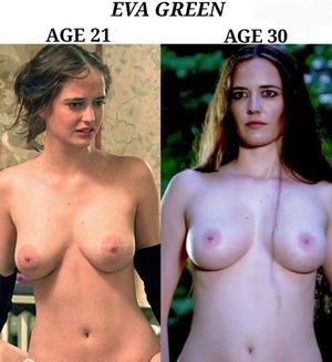 Eva Green breast augmentation