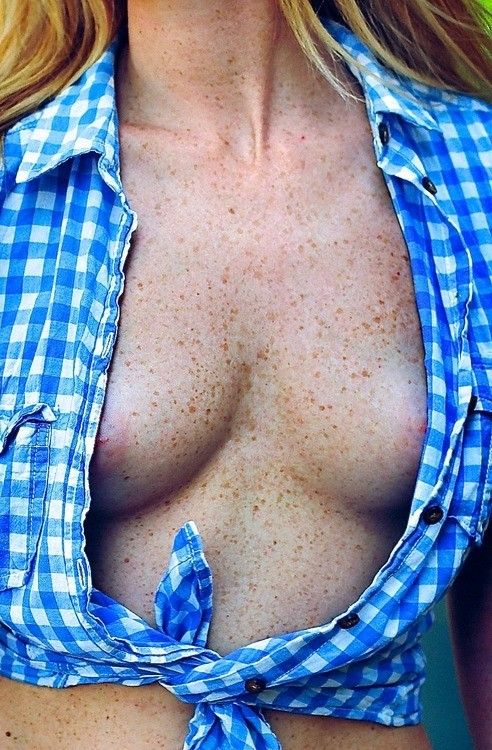 freckled tits