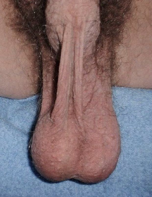 Yam bag