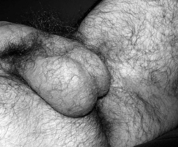 Hairy privates