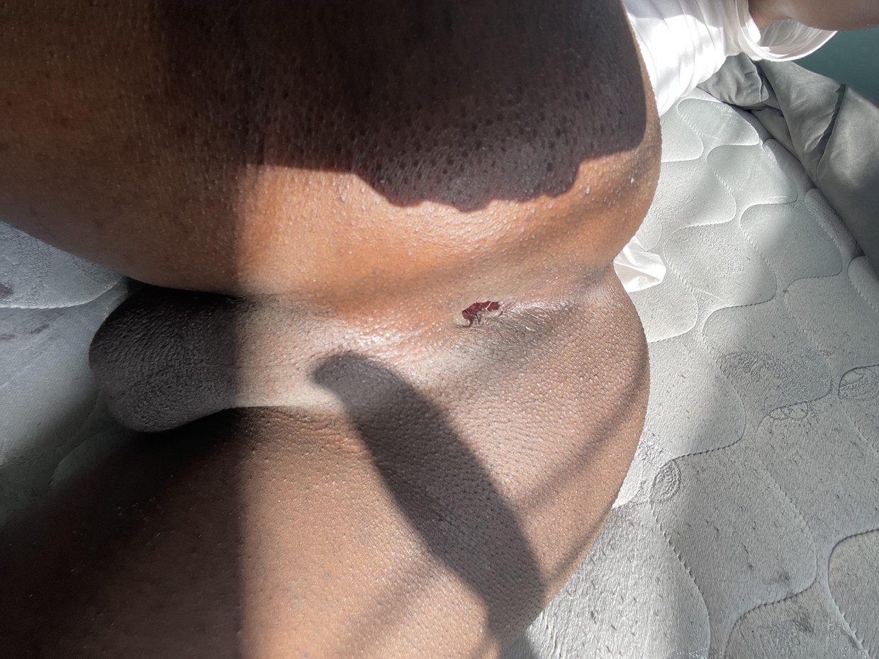 open hole