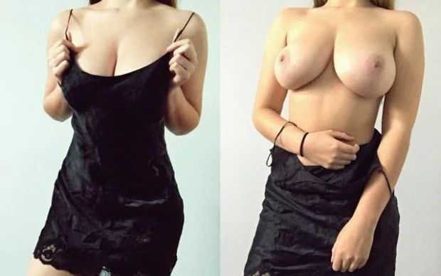 incredible amazing tits before after