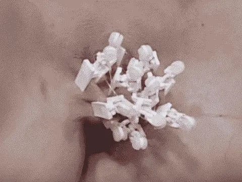 ouch!