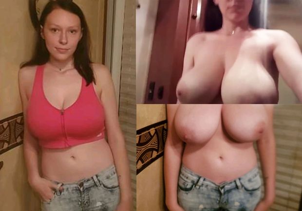 before after
