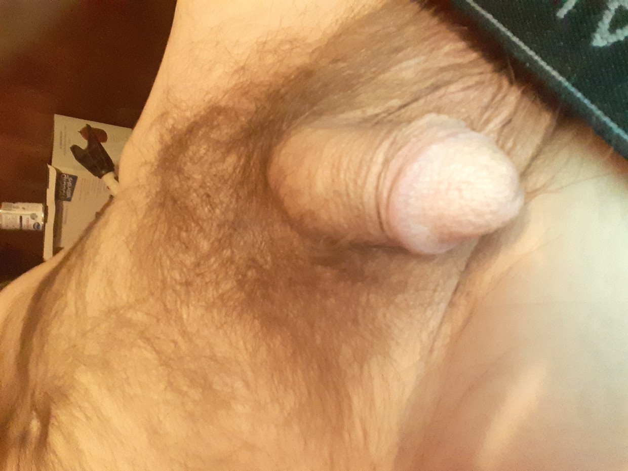Dand5 please comment on it