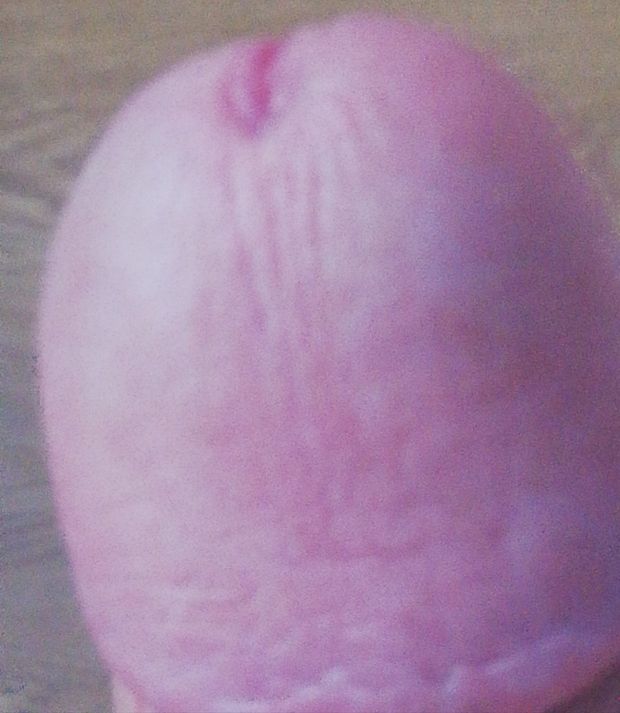 Me
