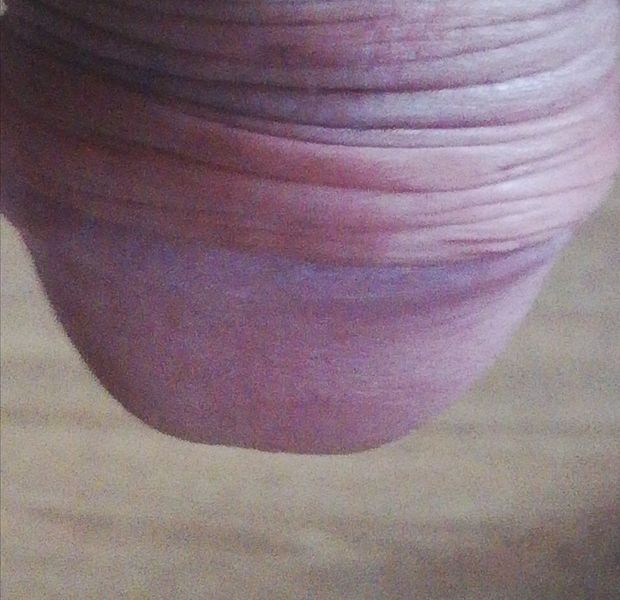 Me dick