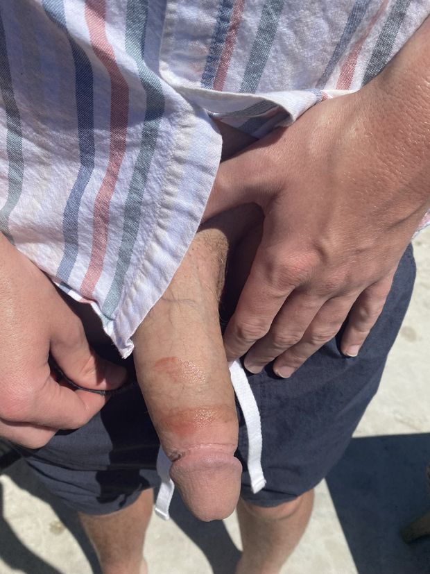 Your girlfriend marks your dick for your wife to see
