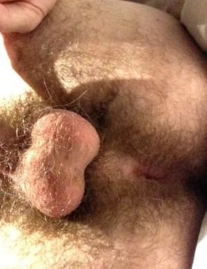 hairy ass and balls