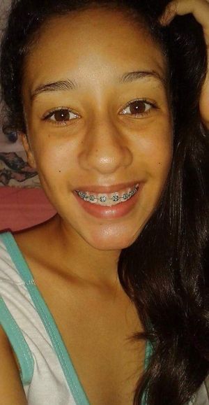 Milena Teen Pretty Brazilian Cute Smile Braces