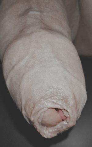 My penis